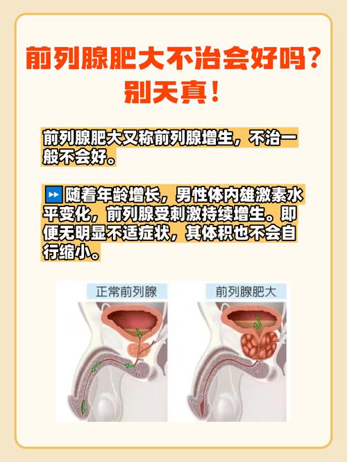 前列腺增大回声欠均匀是怎么回事 前列腺增大回声欠均匀是怎么回事