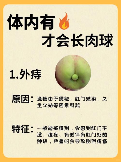 痔疮的痔核是什么 痔疮的痔核是什么