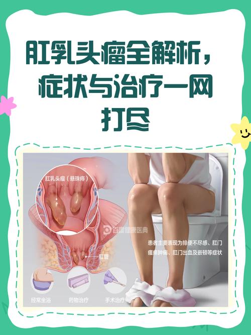 肛乳头长在什么位置 肛乳头长在什么位置