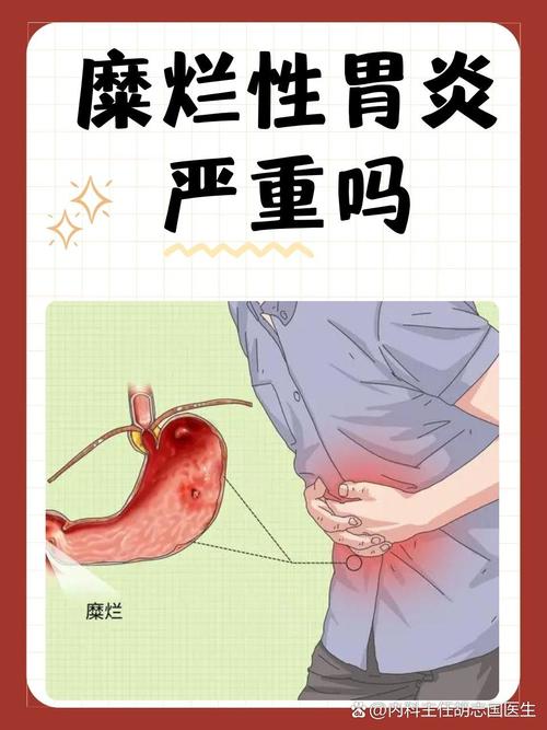 糜烂性胃炎是怎么发生的