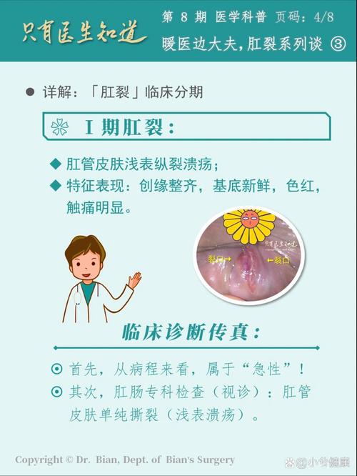 一大便肛门就裂开出血?肛裂的常见临床表现有哪些?