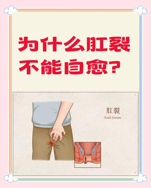 一大便肛门就裂开出血?肛裂的常见临床表现有哪些?