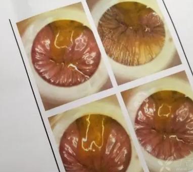 精神类疾病患者该怎么治疗呢? 精神类疾病患者该怎么治疗呢?