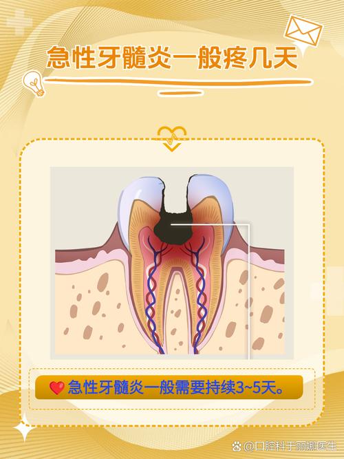 急性牙髓炎是怎么样的