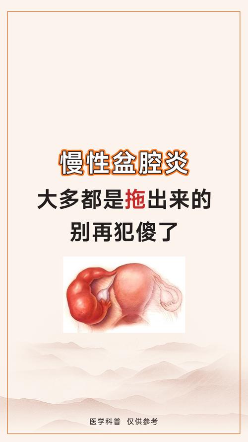 慢性盆腔炎吃什么药效果好? 慢性盆腔炎吃什么药效果好?