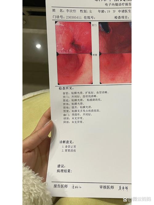 肚子痛拉屎出血怎么办 肚子痛拉屎出血怎么办