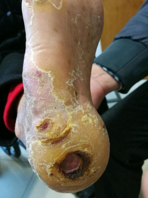 肚子痛拉屎出血怎么办 肚子痛拉屎出血怎么办