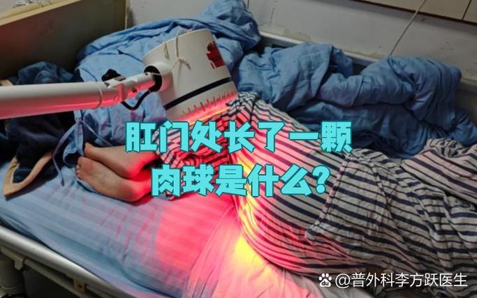 得了血栓性外痔应如何治疗应配合使用什么 得了血栓性外痔应如何治疗应配合使用什么