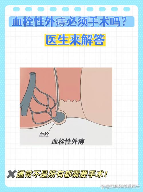 肛门里面一直刺痛,有时疼的就受不了 肛门里面一直刺痛,有时疼的就受不了